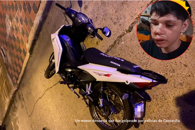Adolescente denunció que fue golpeado por policías tras un accidente en Concordia